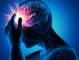Epilepsy