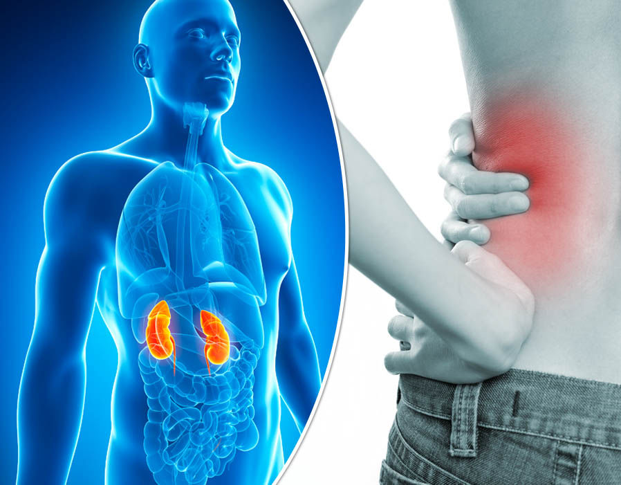 Kidney Disease