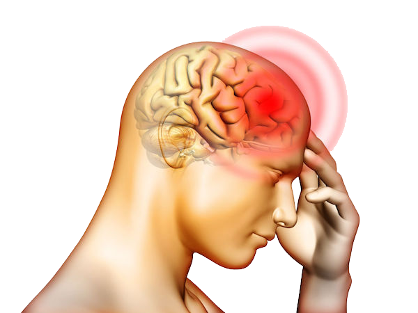 Migraine